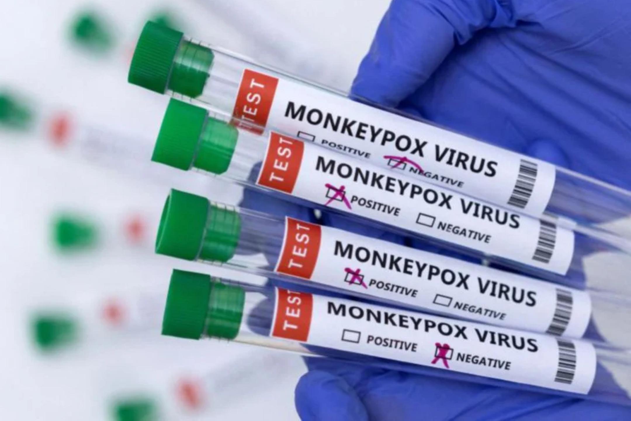 国内新增5宗猴痘病例  患者情况稳定