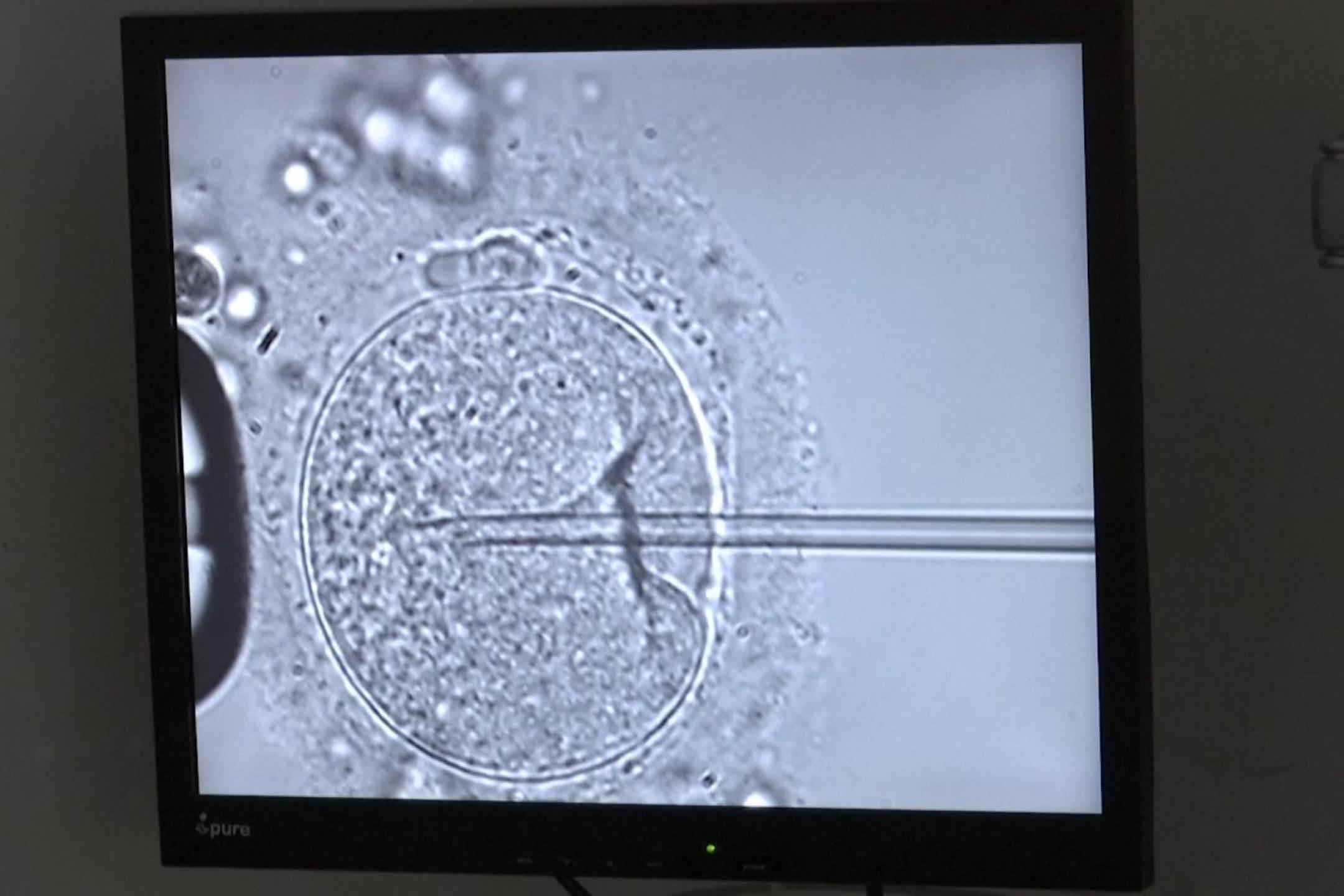 破天荒裁决！ 阿拉巴马高院裁定冷冻胚胎是儿童